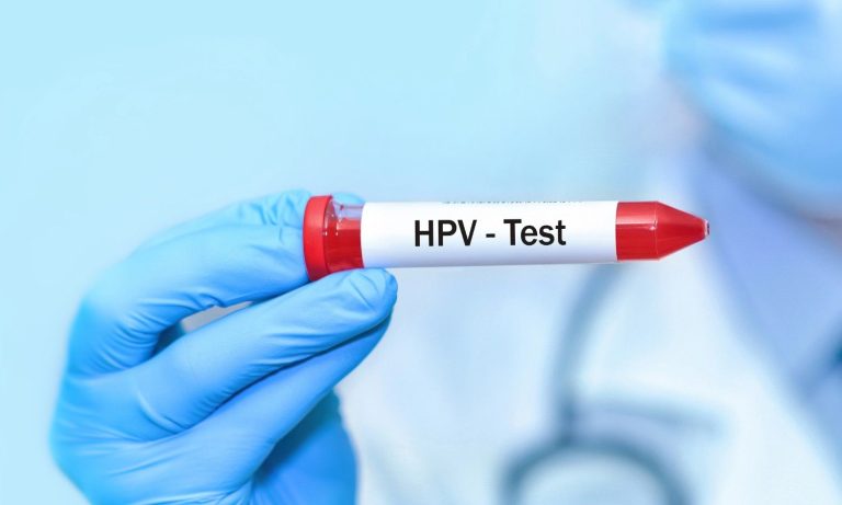 How Much Is STD Testing at Urgent Care Without Insurance?