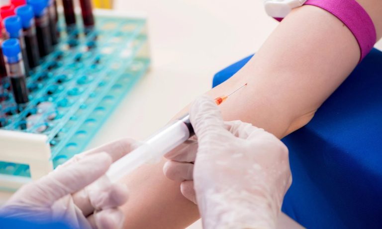 How Are STD Tests Done in Sharpstown? A Professional Guide from Advanced STD Testing & Treatment Clinic