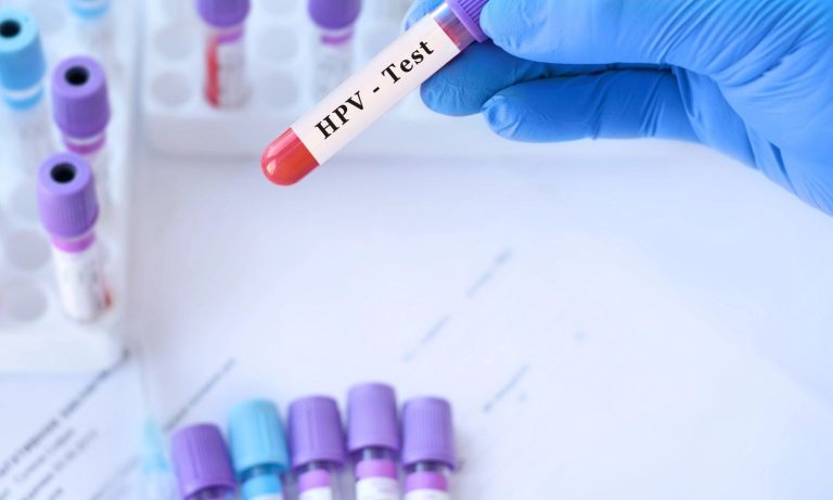 Does Quick Care Do STD Testing?