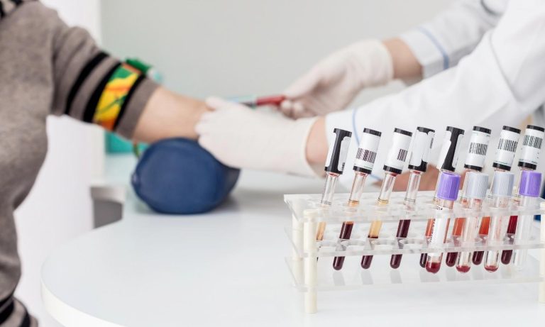 How Long Do STD Tests Take  in Shenandoah?